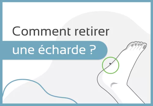 Comment retirer une écharde ?